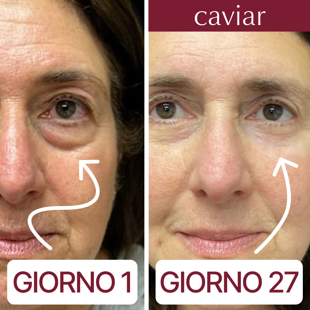 caviar offerta 1+1 - la vera skincare coreana per ringiovanire lo sguardo